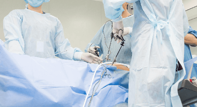 Exploración Laparoscópica de vías biliares en CDMX y Edo. Mex